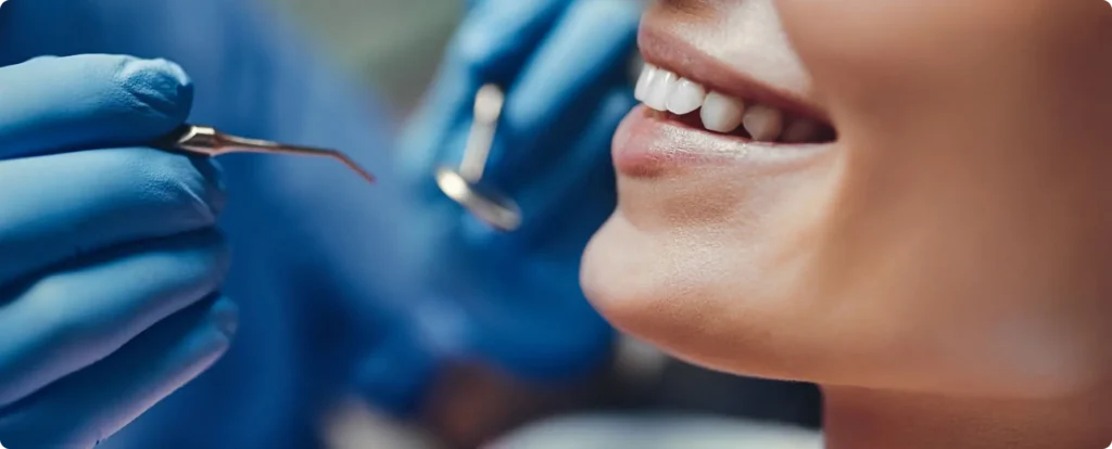 prothese fixe rehabilitation complete nueil les aubiers All-on-6 Jeunesse