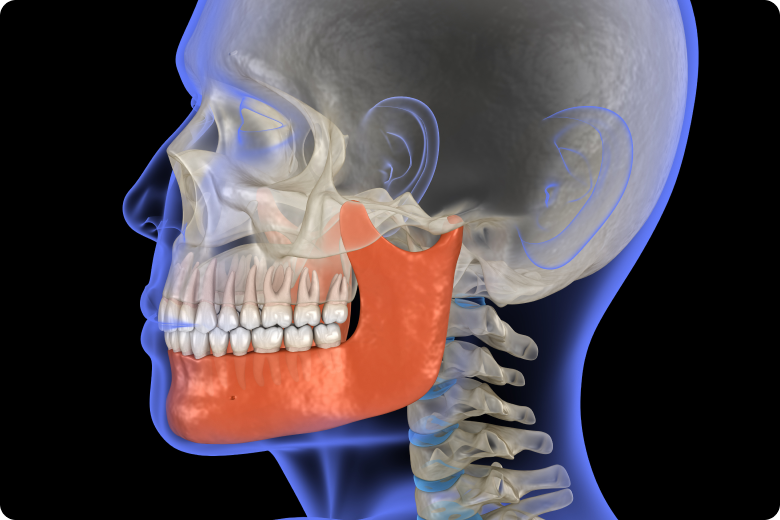 appareils dentaires rehabilitation complete nueil les aubiers Mauvais alignement dentaire Jeunesse