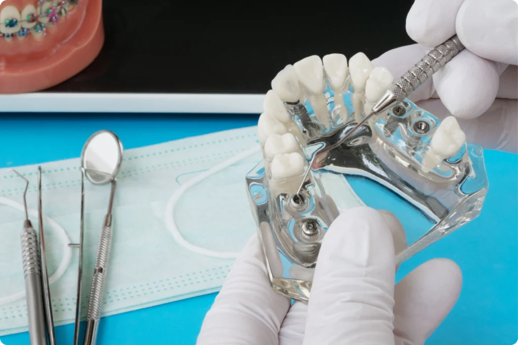 chirurgie dentaire guidee nueil les aubiers Implant dentaire près de Parthenay Jeunesse