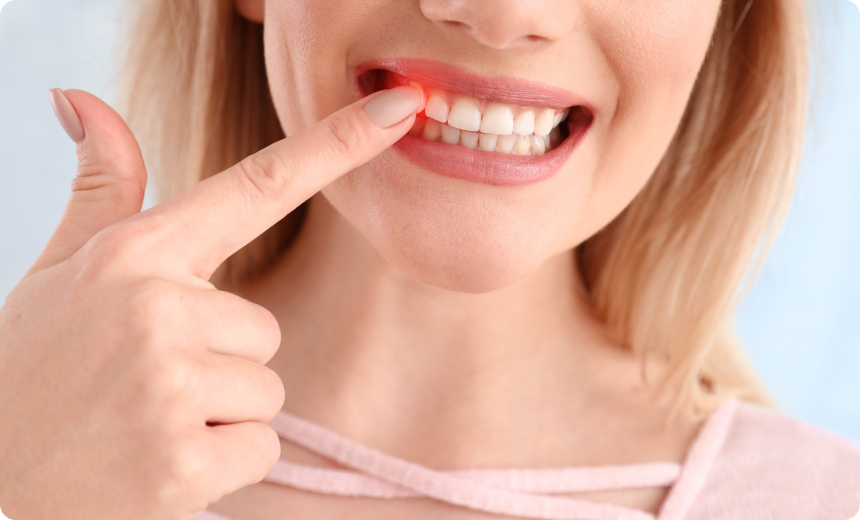 surcqge rehabilitation complete nueil les aubiers Kystes Jeunesse